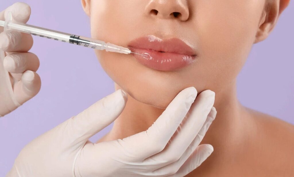 lips, lip filler, filler, botox, facial treatment, injection, beauty, botox, botox, botox, botox, botox